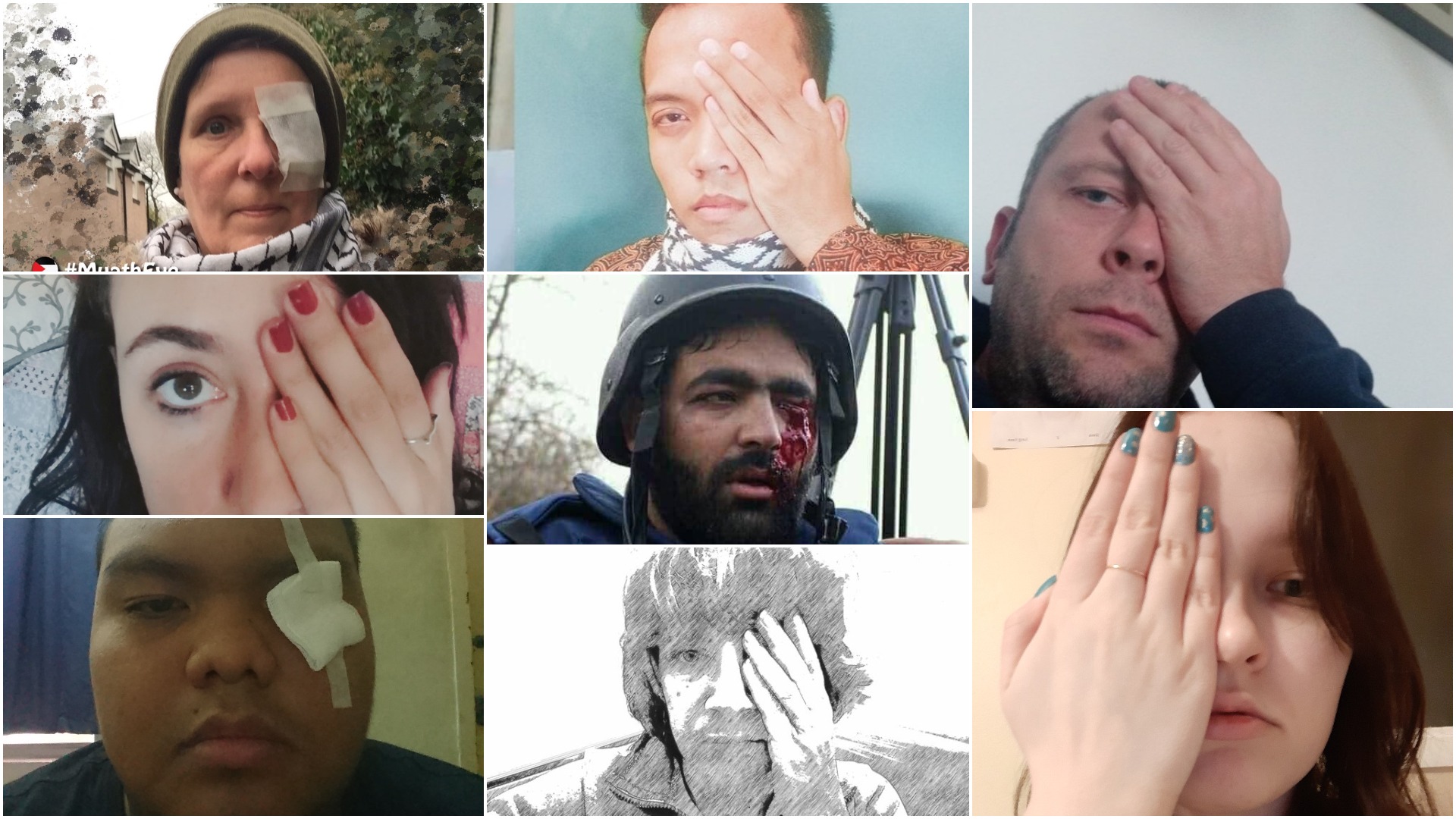 "Muath's eye".. The world stands in solidarity with Palestinian blinded journalist