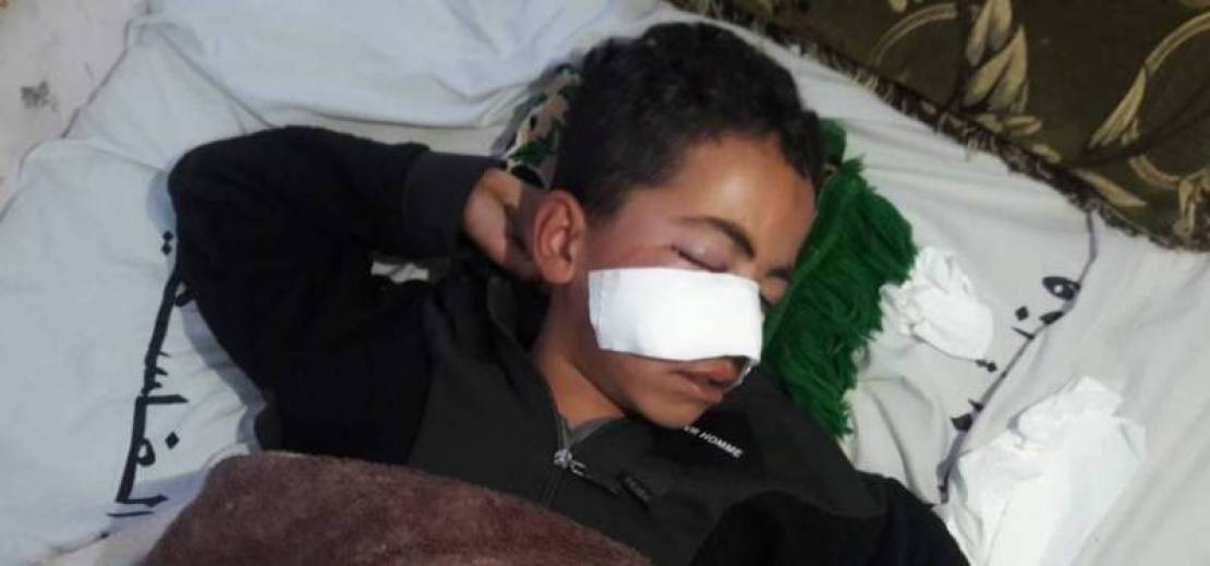 Muhammad Abu Reidah.. The Gaza child who was wanted to be a moving hunting target