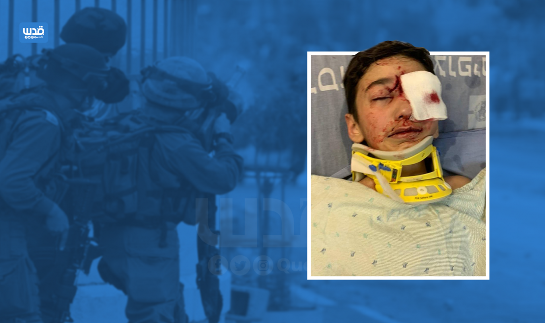 Israeli eyes' hunters probably succeed to hunt another child's eye