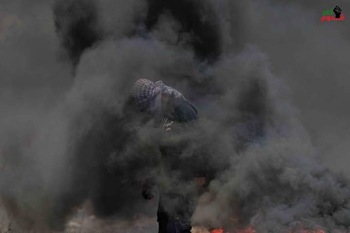 Pictures| Injuries in Israeli repression of peaceful weekly protest