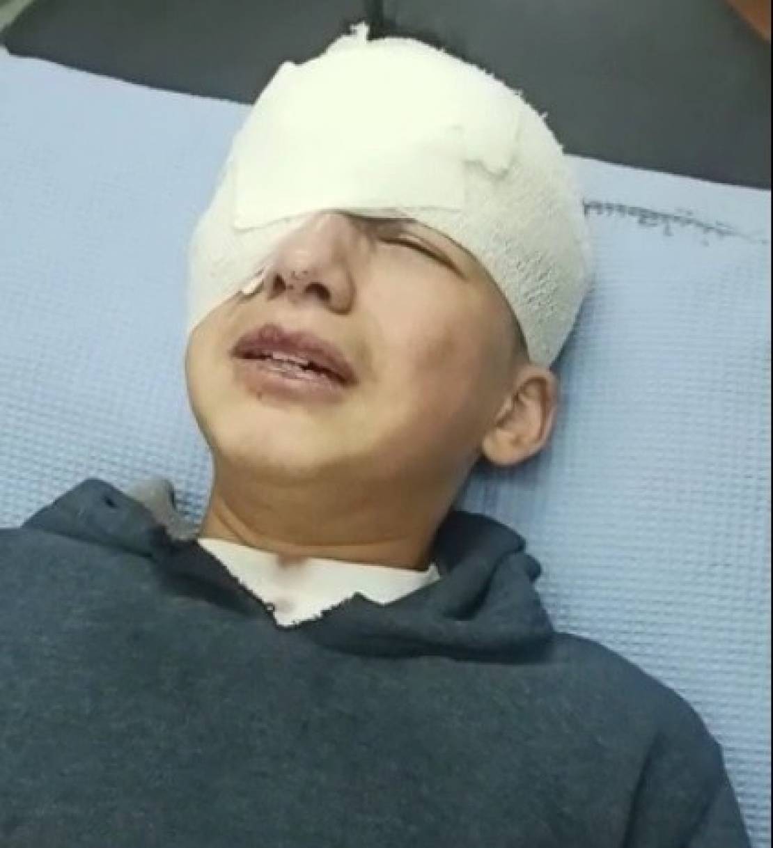 Israeli sniper shoots child, blinding one eye