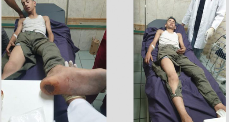 Israeli settlers kidnap, torture 15-year-old in Jenin