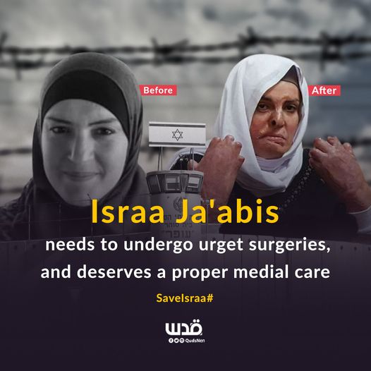 Israa Jaabis: Six years passed in Israeli jails while her burns still bleeding