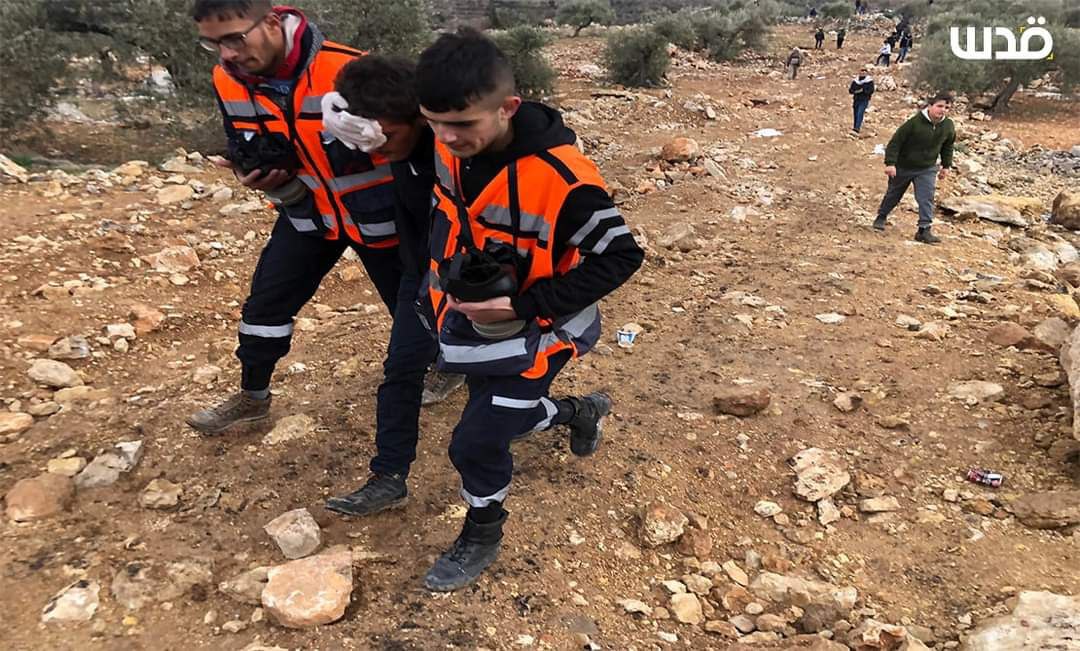 BREAKING| Palestinian youth injured with Israeli rubber-coated metal bullets in Beita