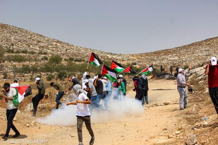 BREAKING| Palestinian youth injured with Israeli rubber-coated metal bullets in Beita