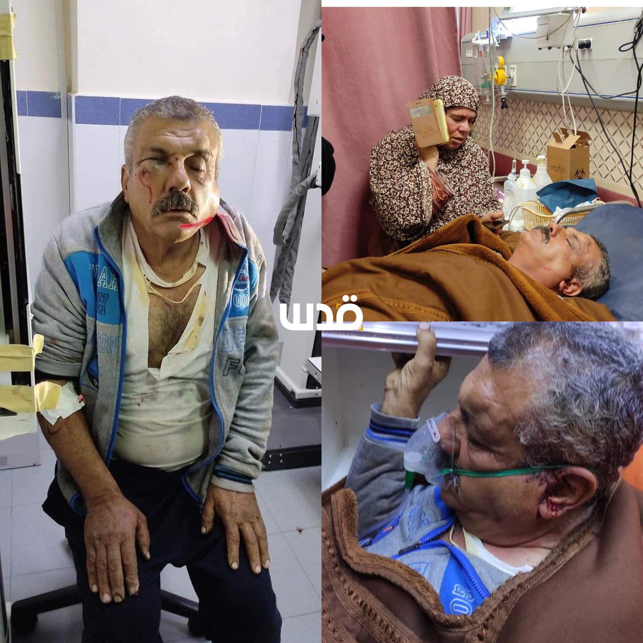 Israeli settlers violently attack Palestinians' houses in Nablus, injure several