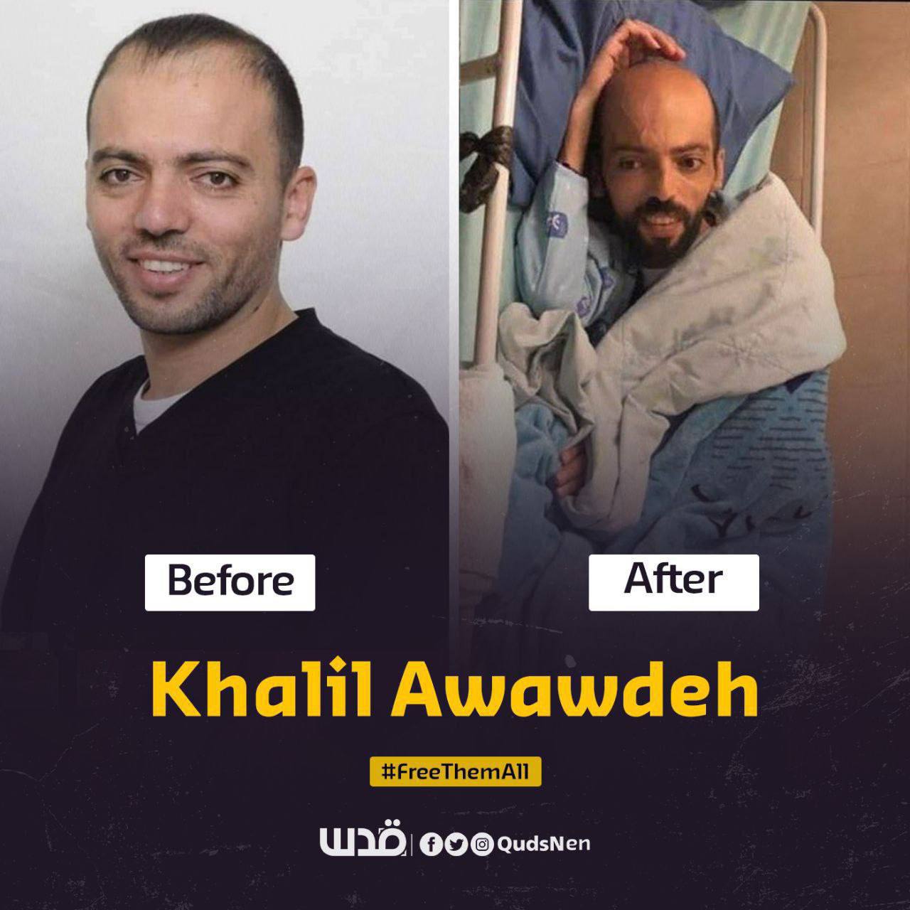 Detainee Khalil Awawdeh suffers from acute dyspnea and time is running out to save him, says report