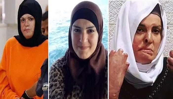 Israa Jaabis: Eight years passed behind Israeli prison bars while her burns still bleeding