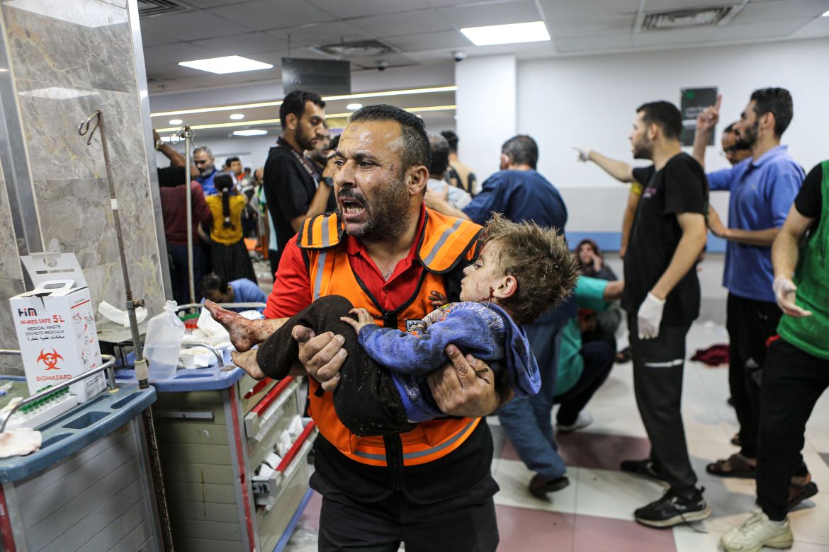 Fatigued Gaza medical personnel handling unprecedented challenges, says British physician