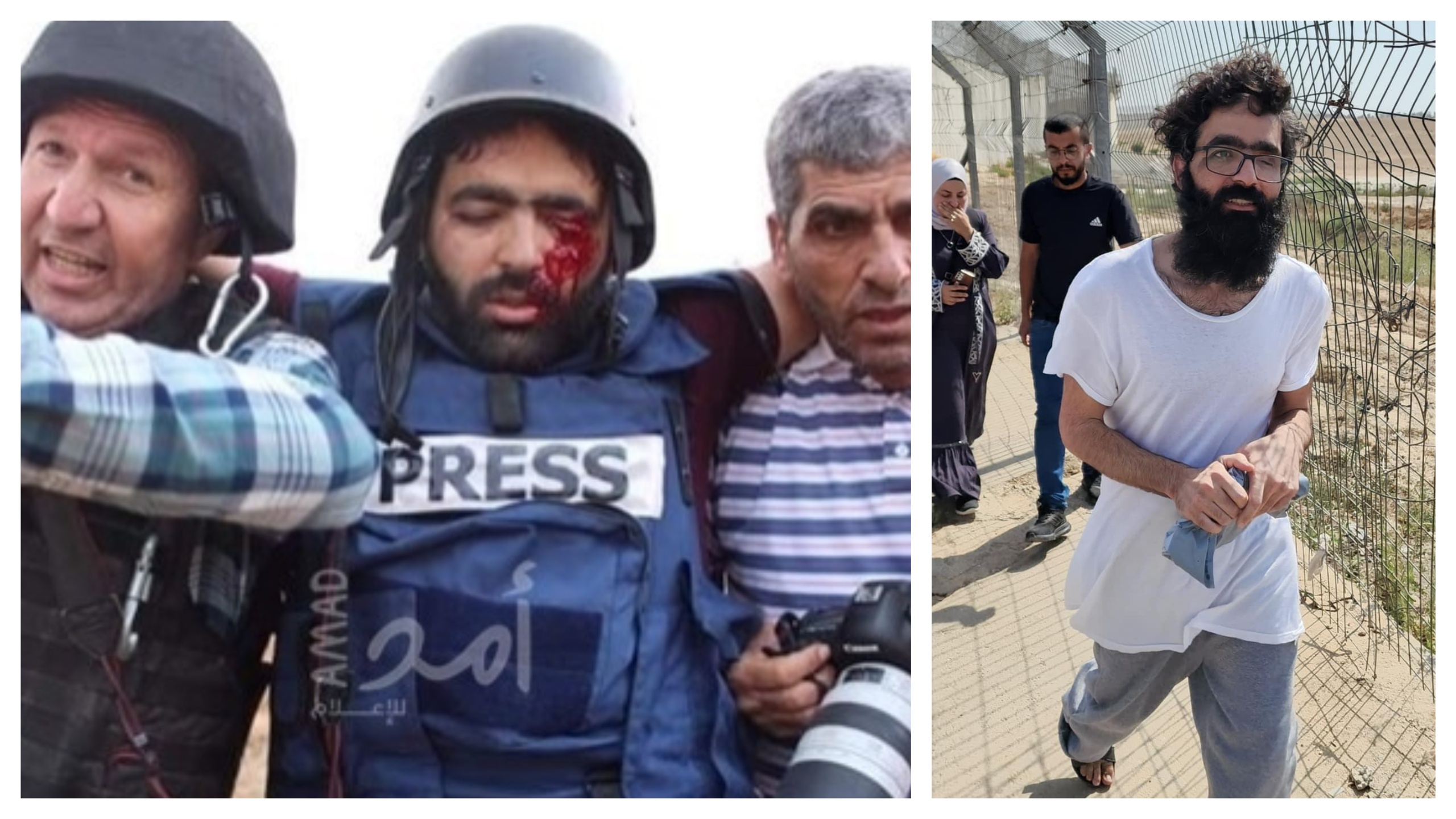 Israel releases journalist shot in the eye