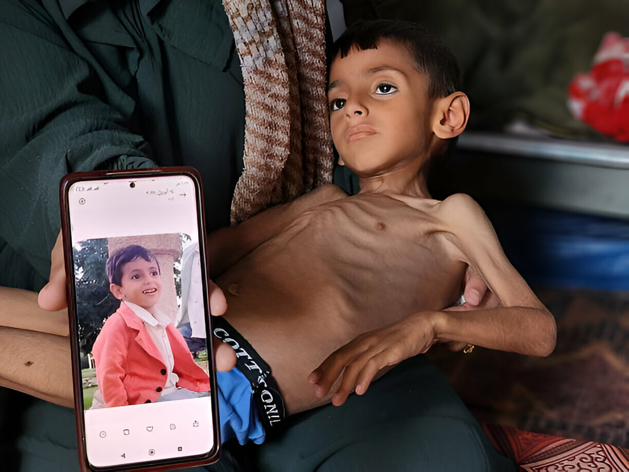 Haaretz: Starving Gaza Does Not Achieve Any of Israel’s War Goals