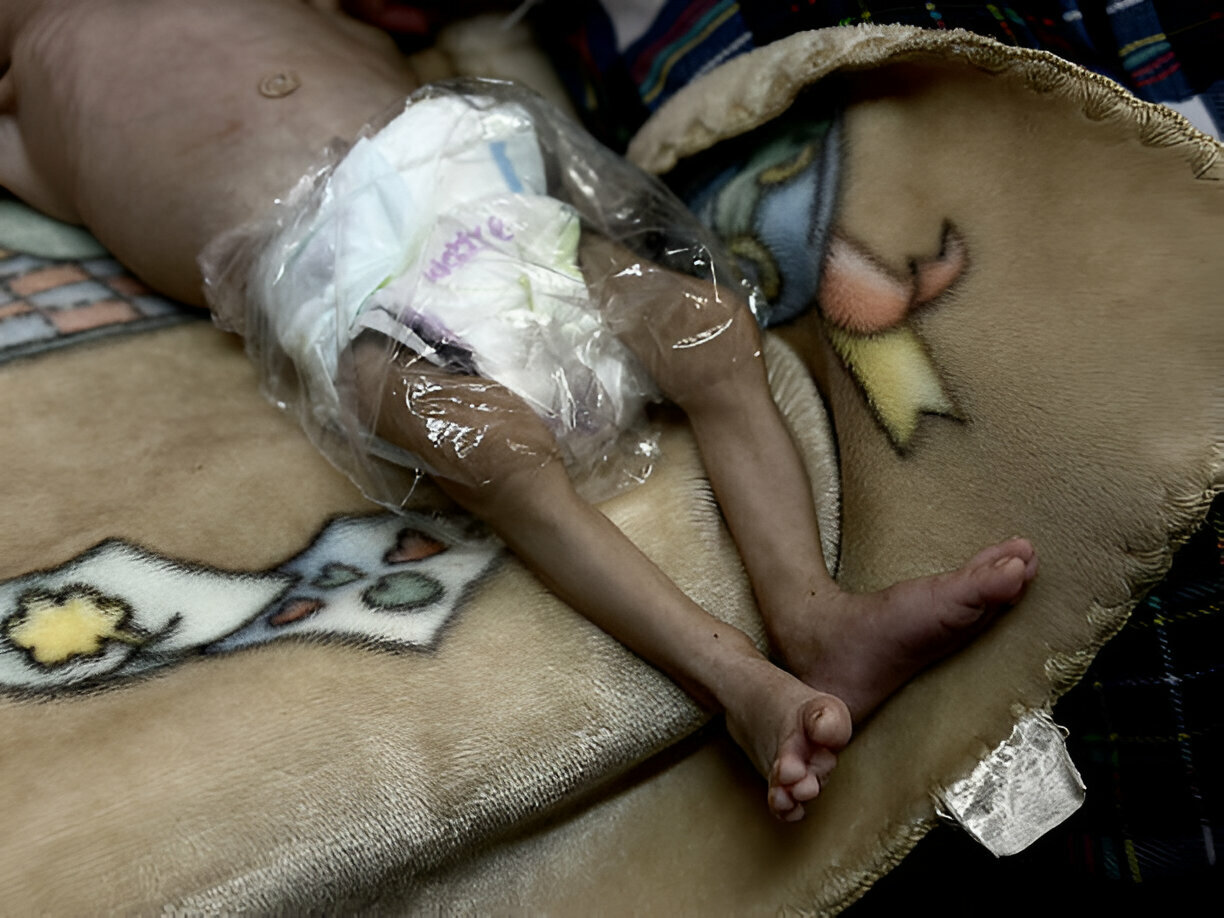 Gaza Enters Fifth Phase of Famine as Israel Continues to Block Aid for Third Month
