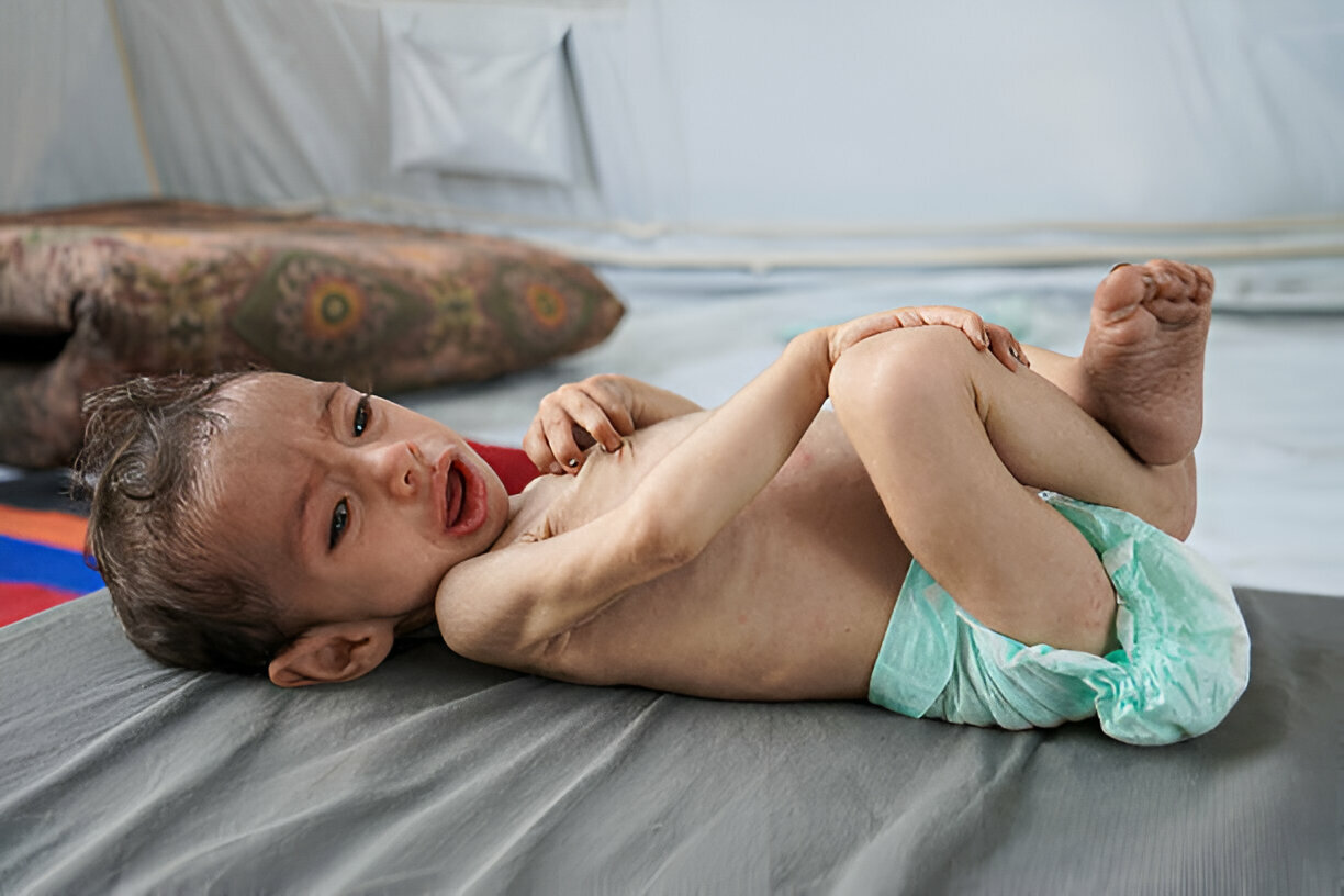 UNRWA Chief: No Safe or Significant Aid in Gaza for Over 3 Months