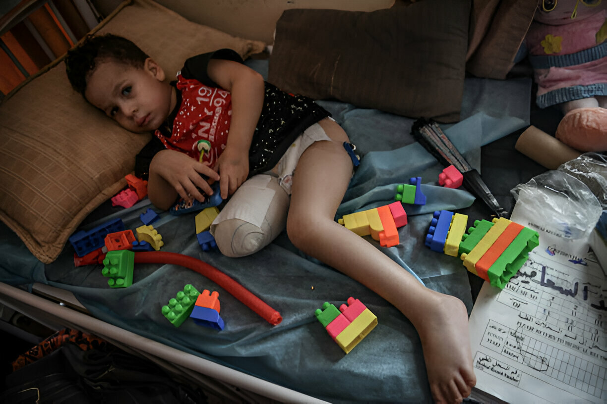 Gaza’s Children: 23% of Amputations, 33% of Brain Injuries, 70% of Burns, and Zero Rehab Services