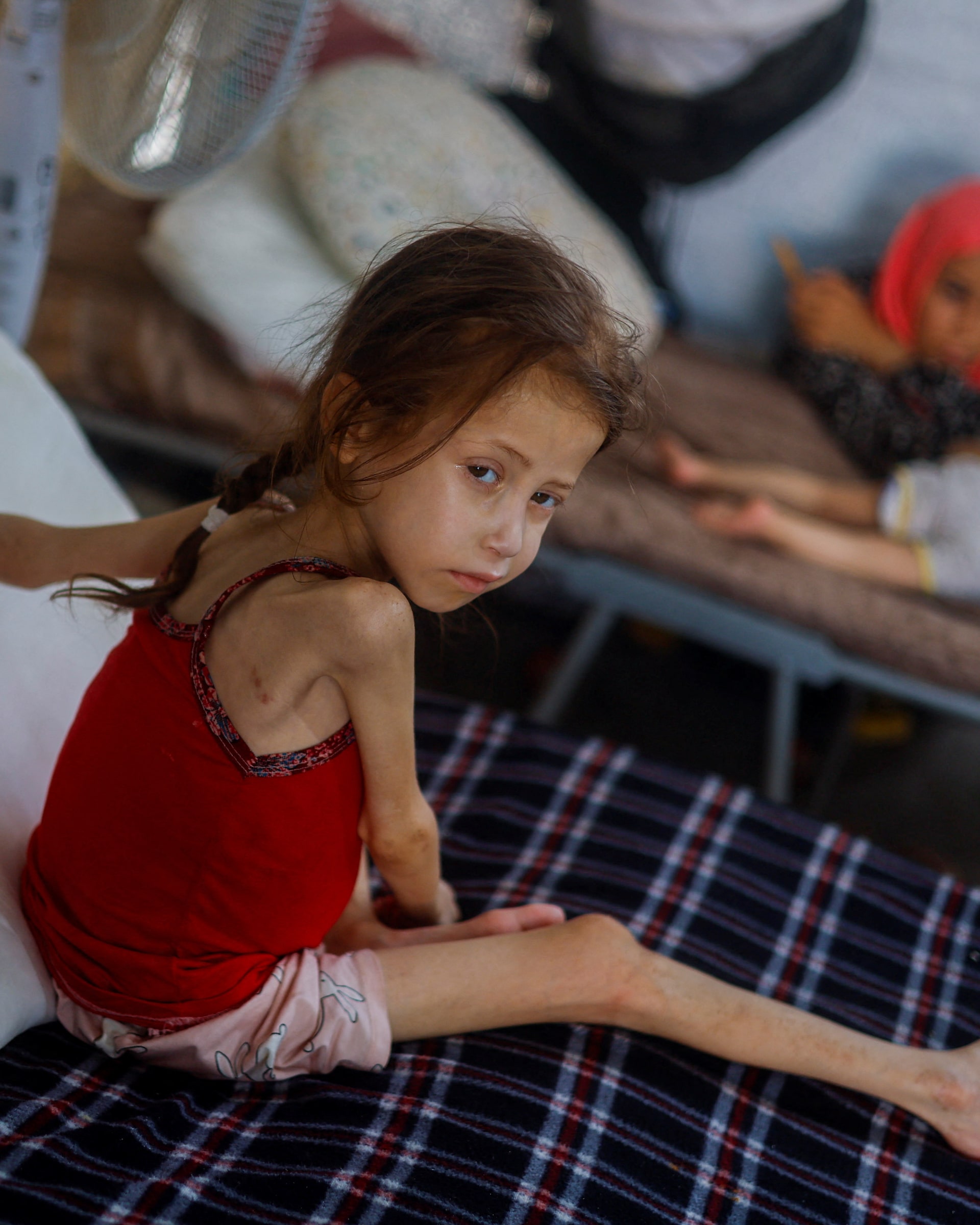 About 19,000 Children in Gaza Admitted for Acute Malnutrition in 2025: UN