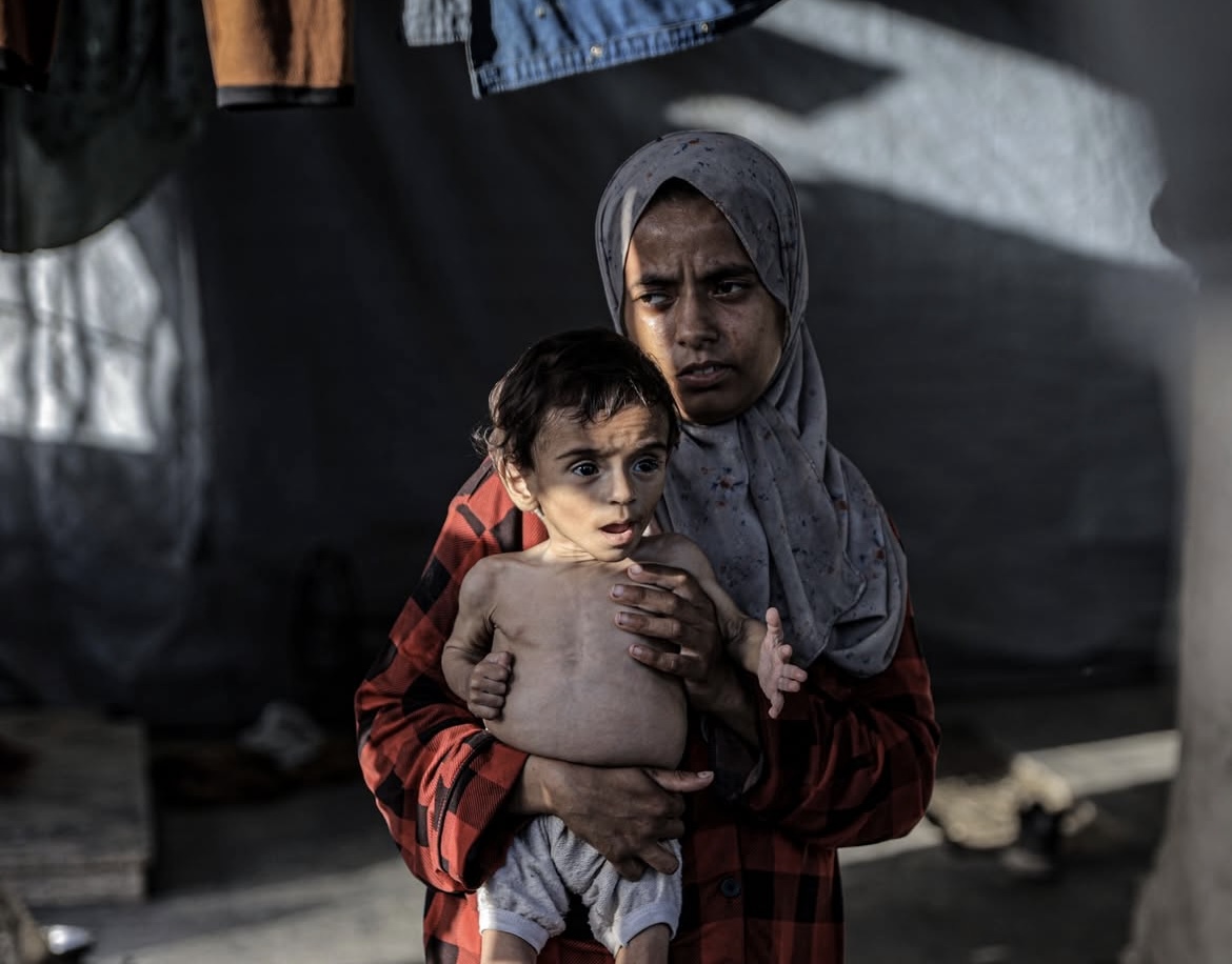 At Least 18 Palestinians Died of Hunger in Gaza on Sunday Amid Israeli-Made Famine