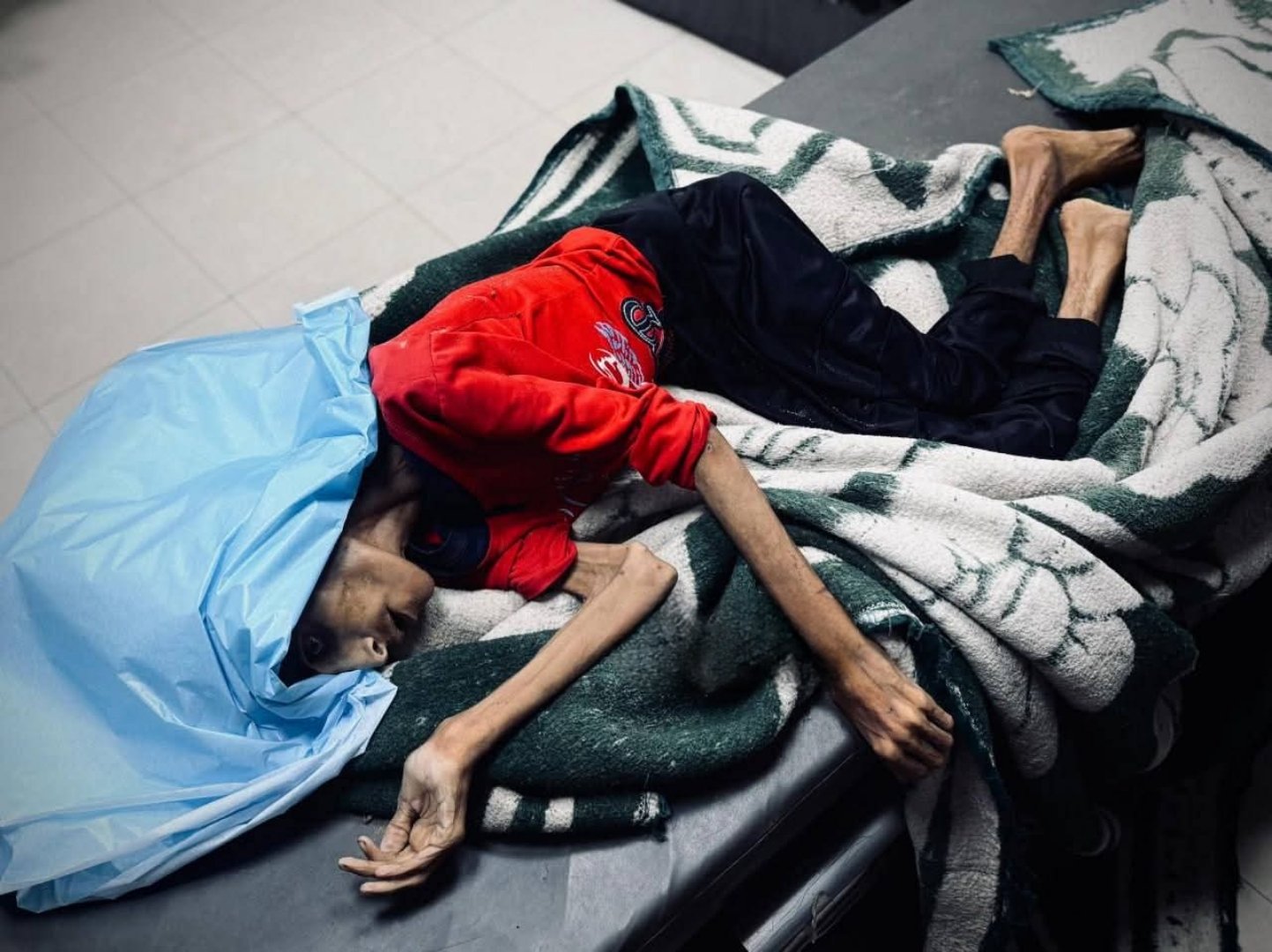 Four, Including Two Children, Die from Malnutrition in Gaza Amid Israeli-Made Famine