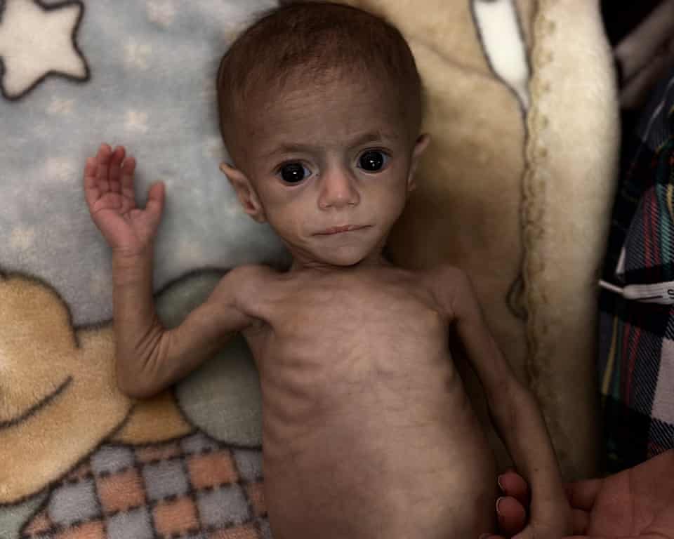 Gaza: Tens of Thousands of Infants Could Die Without Baby Formula Amid Israeli Siege