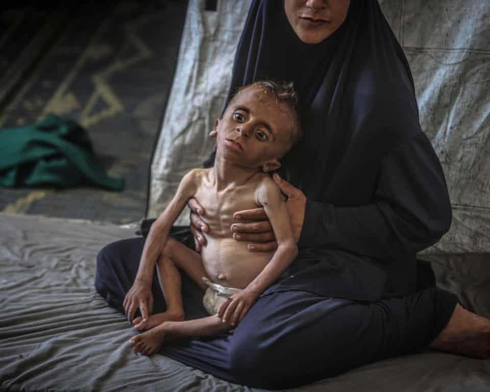 “Worst-Case Scenario of Famine is Currently Playing Out” in Gaza: Global Hunger Monitor