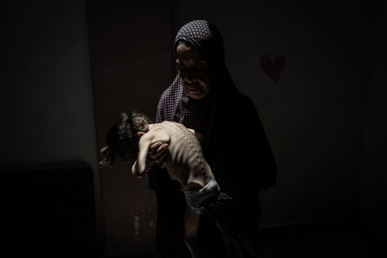 Two More Palestinians Starve to Death Amid Israeli-Made Famine in Gaza