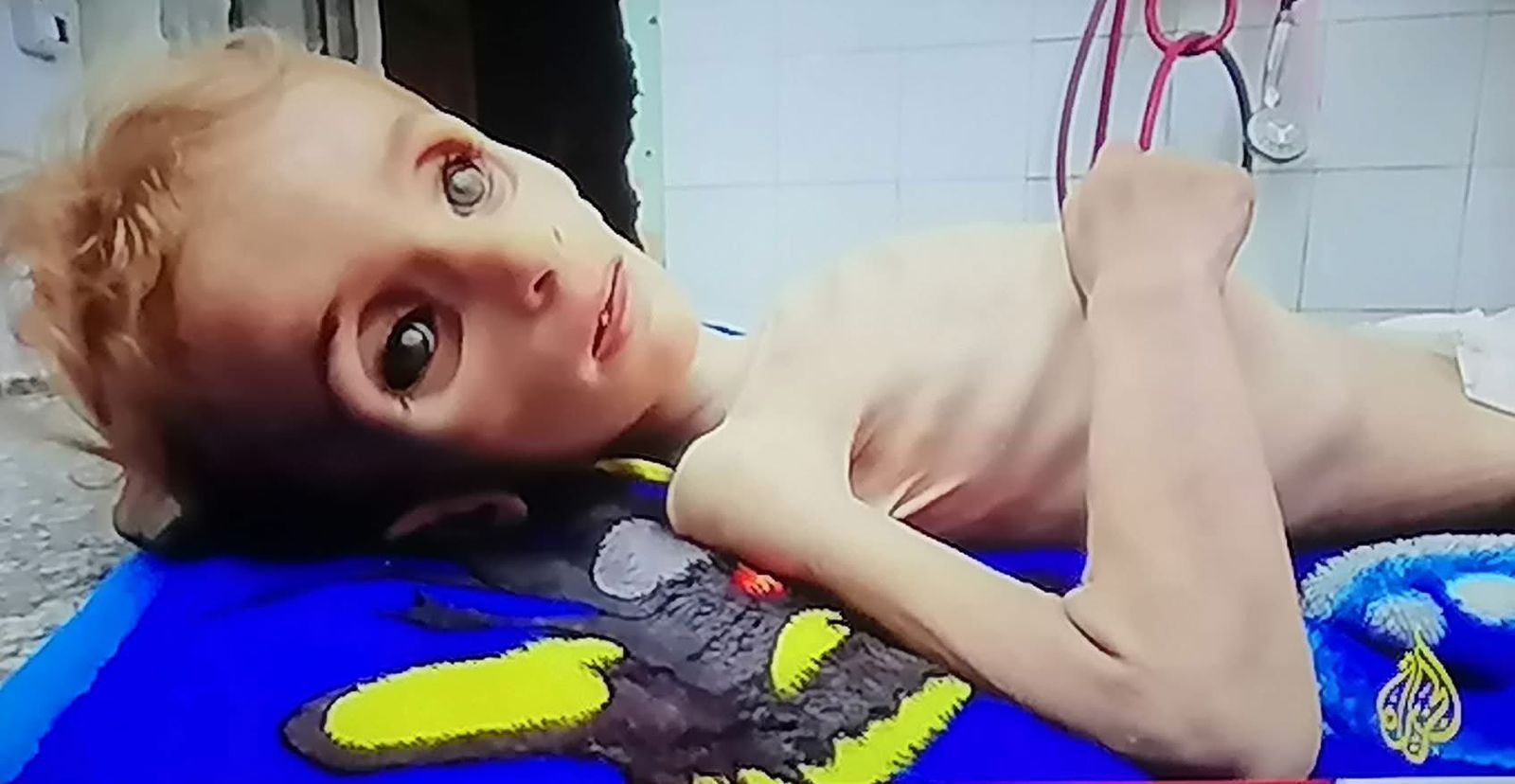 Malnutrition Kills 69 Children in Gaza as Israel’s Blockade Triggers Mass Starvation