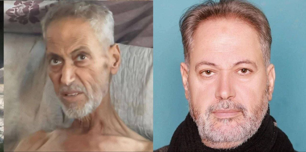 Gaza: University Lecturer Among Three Palestinians Who Died from Malnutrition in Past 24 Hours Amid Israeli-Made Famine