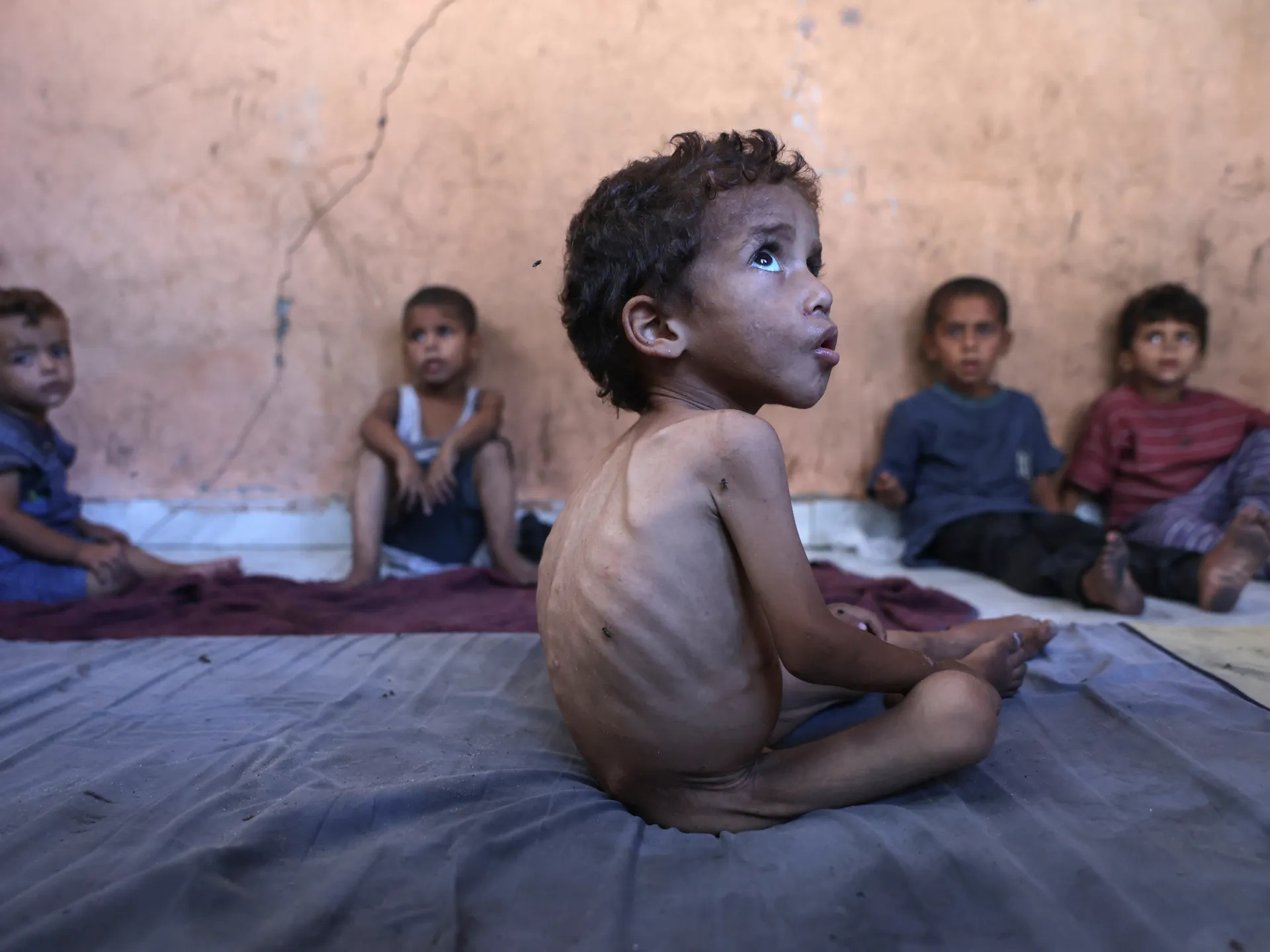 UNICEF: Acute Malnutrition Threatens More Than 9,000 Babies in Gaza