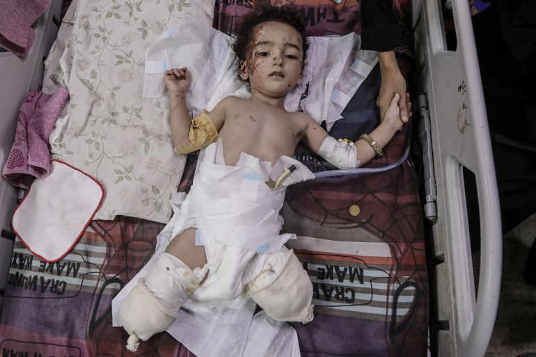 NGO Warns Gaza Amputee Numbers, Already at Record High, May Increase Amid Ongoing Israeli Blockade