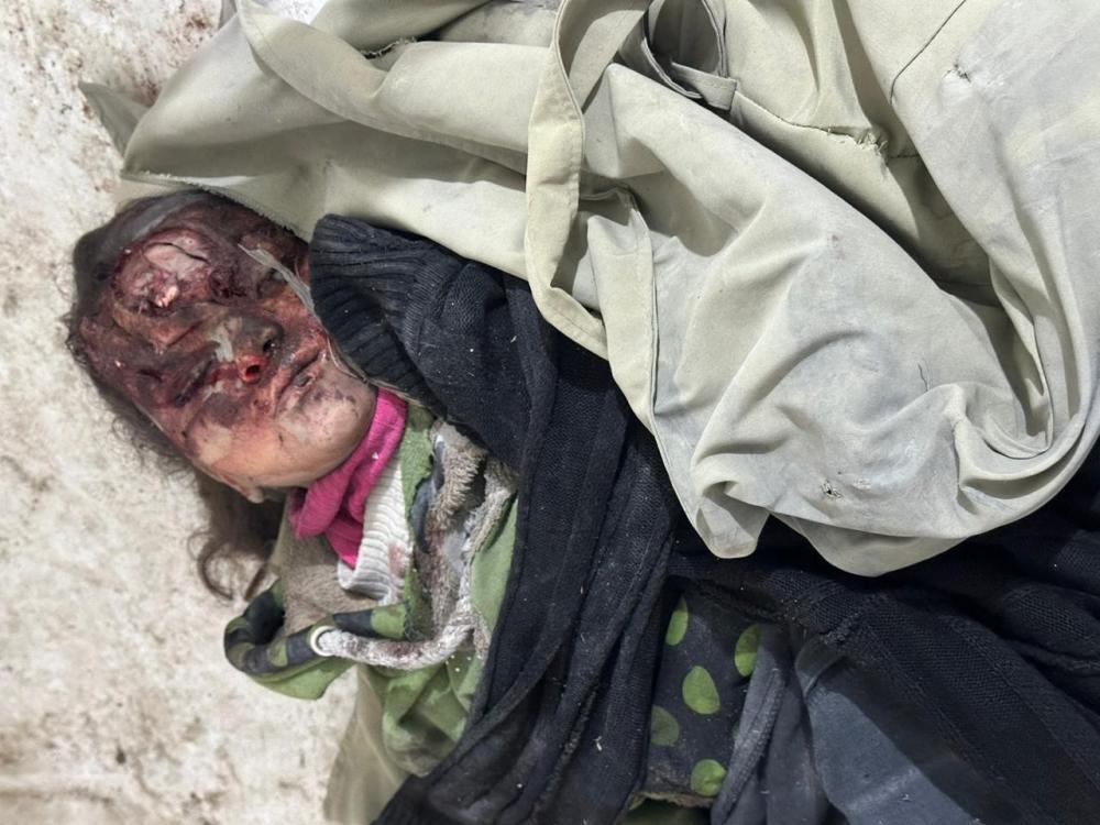 الأورومتوسطي: نحو 25 ألف شهيد في غزة بينهم 10 آلاف طفل