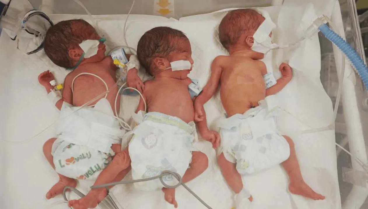 الأمم المتحدة: كارثة إنجابية تتفاقم في غزة