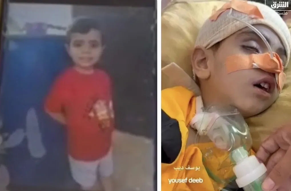 استشهاد طفل فلسطيني متأثراً بإصابته في غارة على الزوايدة