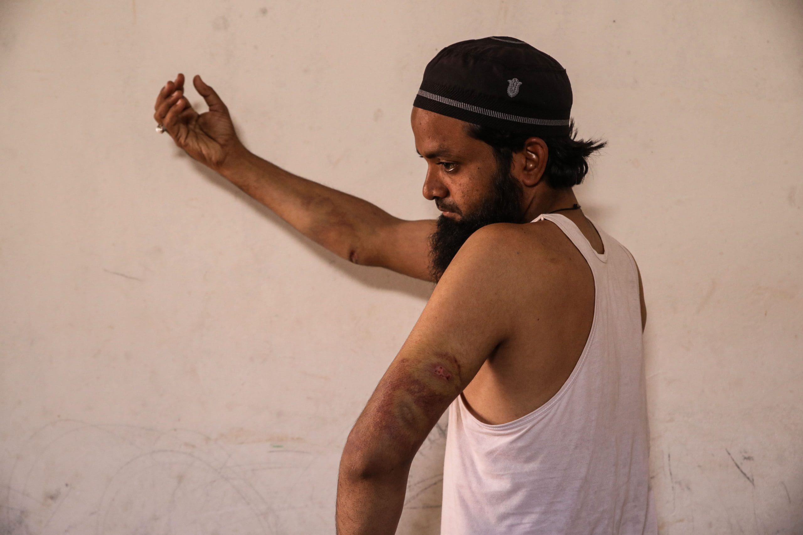 "Why so barbarous?" asks Muslim man assaulted in viral video from Khargone