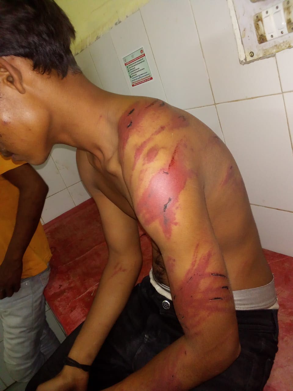 Uttar Pradesh: Dalit youth in Raebareli attacked over suspicion of theft, FIR registered