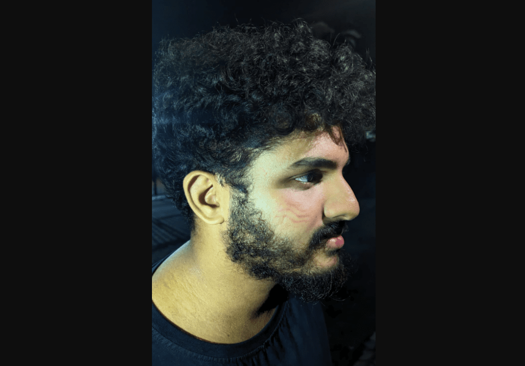 4th attack in 3 weeks: Anti-govt protesters assaulted by CPI(M) mob during CM Pinarayi Vijayan's statewide outreach program