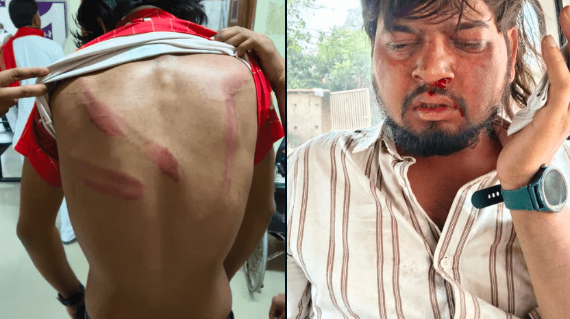 MP: Students allege life-threatening attacks by ABVP–RSS at Dr. Hari Singh Gour University; FIR filed, no arrests yet