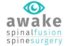 Awake Spinal Fusion