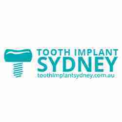 Toothimplantsydney