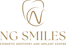 NG Smiles