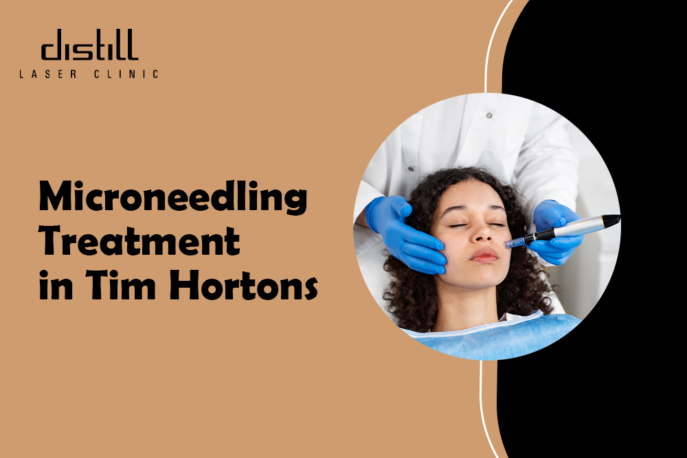 microneedling north york