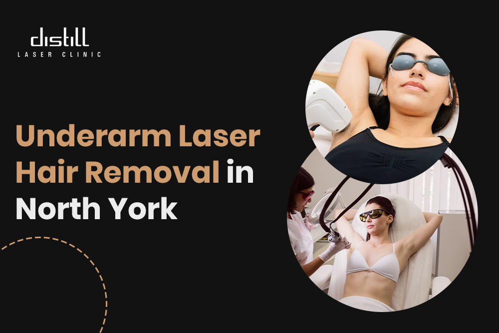 Underarm Laser Hair Removal North York