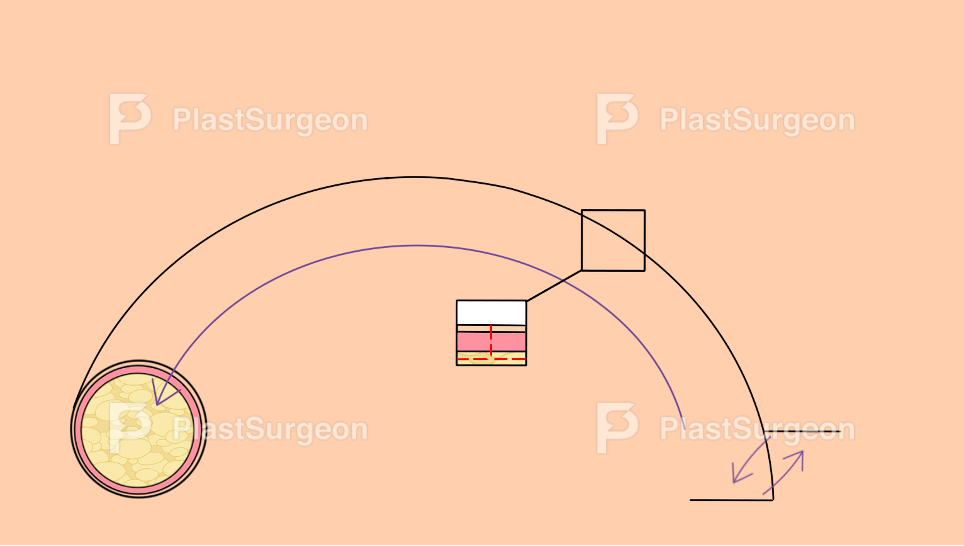 Diagram of skin layers and cell structure.