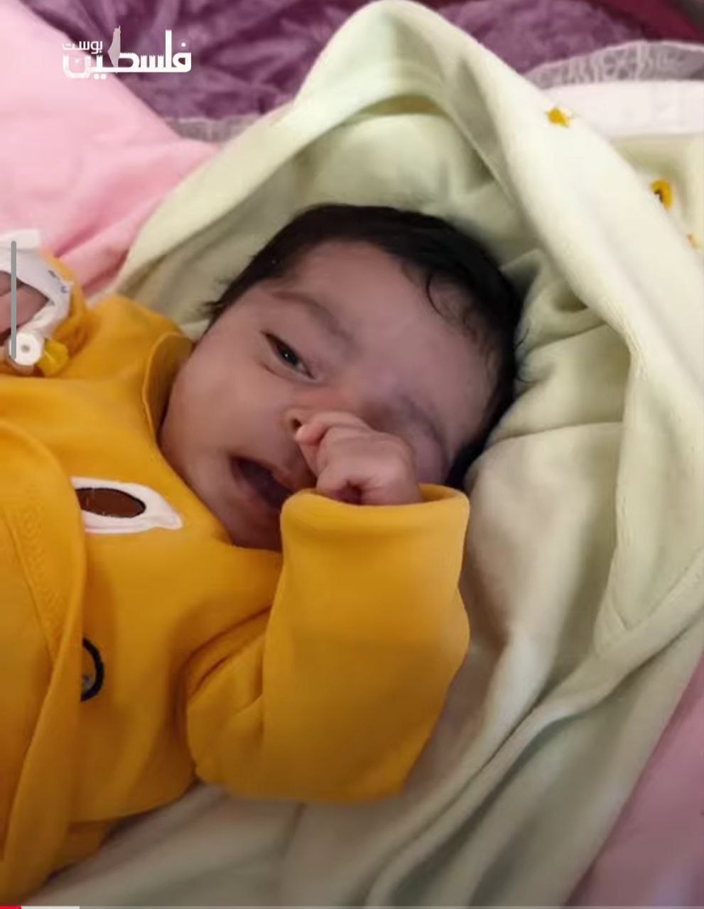 الطفلة غزل حرزالله، 26 يوماً تواجه خطر بتر أطرافها بسبب مرض نادر وتدهور صحتها في غزة