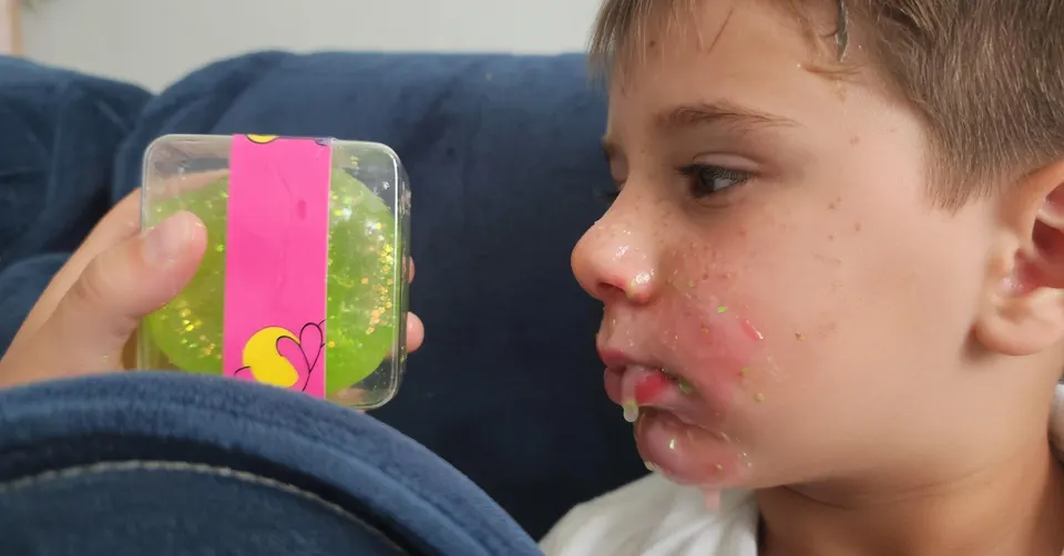 Melvyn met kleverige gel op zijn gezicht na het barsten van een squishy