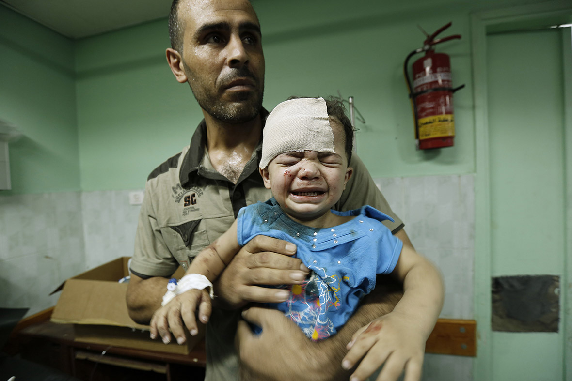 استشهاد فلسطيني بجروح سابقة في غارات على غزة