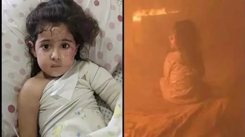 طفلة غزية تنجو من النيران وتفقد والديها في قصف