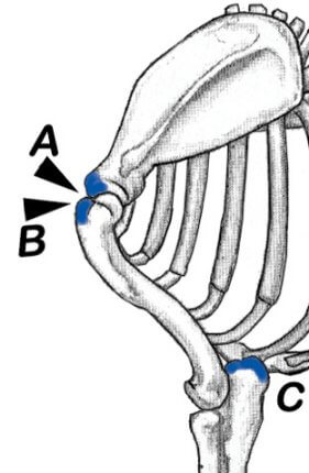 Figure 12. Location of the 'Notch' at the Junction of the Shoulder Blade and the Upper Arm. Figure 12. Location of the 'Notch' at the Junction of the Shoulder Blade and the Upper Arm.