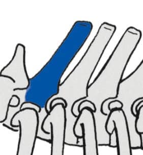 Figure 3. 1st Thoracic Vertebra Measuring Proportions and Finding Landmarks: Part 2