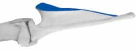 Figure 7. Spine of Scapula in Profile Figure 7. Spine of Scapula in Profile