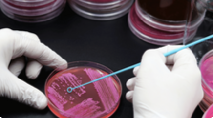 Grundlagen der Mikrobiologie und Bauphysik