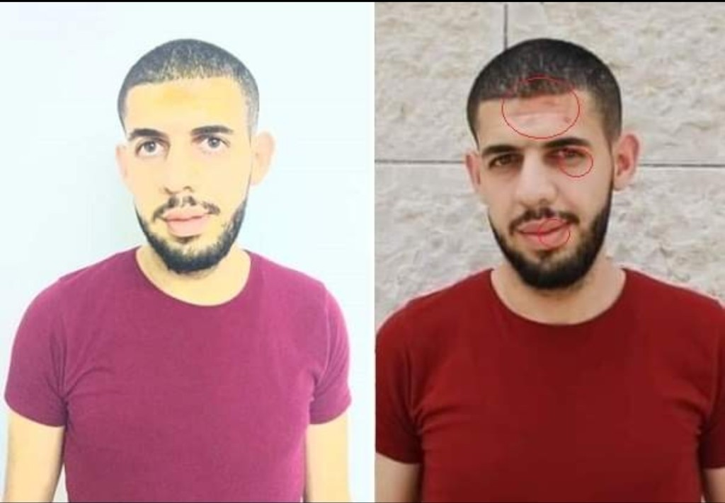 الاعتداء على الصحفي أنس حواري حقيقة ام فوتوشوب